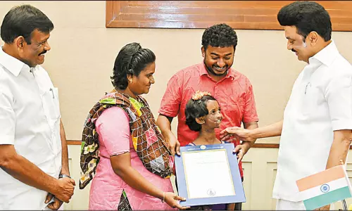 முகச்சிதைவு நோயால் பாதிக்கப்பட்டு சிகிச்சை பெற்ற சிறுமி தானியாவுக்கு வீட்டு மனை பட்டா: முதல்-அமைச்சர் வழங்கினார்