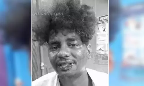 மோட்டார் சைக்கிள் தர மறுத்தவரின் உதட்டை கடித்து கொலை மிரட்டல் மோட்டார் சைக்கிள் தர மறுத்தவரின் உதட்டை கடித்து கொலை மிரட்டல்