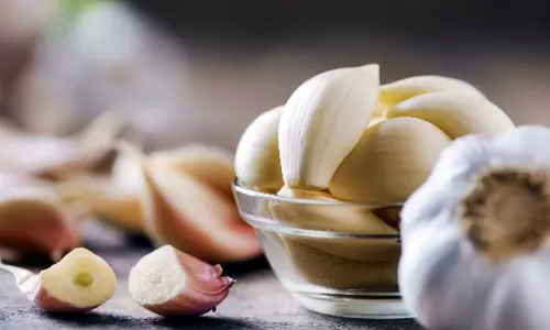 தக்காளி, பருப்பு விலையை தொடர்ந்து பூண்டு விலையும் எகிறியது - ஒரு கிலோ ரூ.180-க்கு விற்பனை