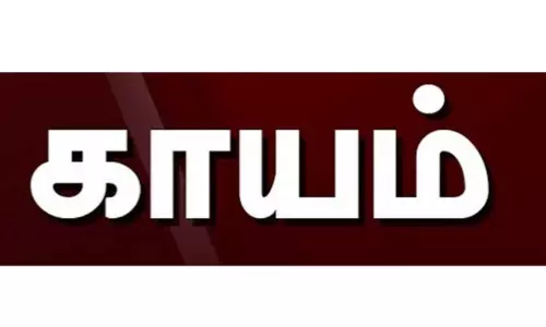 மின்சாரம் தாக்கி பெண்கள் உள்பட 4  பேர் காயம்