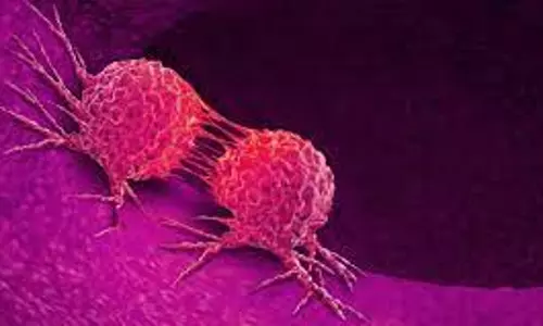 திண்டுக்கல் அரசு மருத்துவமனையில் கர்ப்பப்பை வாய் புற்றுநோய் அறுவை சிகிச்சை திண்டுக்கல் அரசு மருத்துவமனையில் கர்ப்பப்பை வாய் புற்றுநோய் அறுவை சிகிச்சை