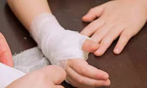 ராமேசுவரம் கோவிலில் கூட்ட நெரிசலில் கீழே விழுந்த பெண் காயம்