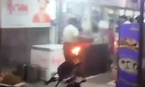 தீப்பற்றிய ஆடையுடன் பேக்கரிக்கு சென்ற வியாபாரி