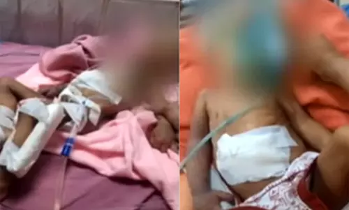 சென்னை அரசு மருத்துவமனையில் கை அகற்றப்பட்ட குழந்தை உயிரிழப்பு..!