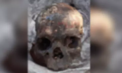 குப்பையில் கிடந்த மண்டை ஓடு: துப்புரவு ஊழியர்கள் அதிர்ச்சி