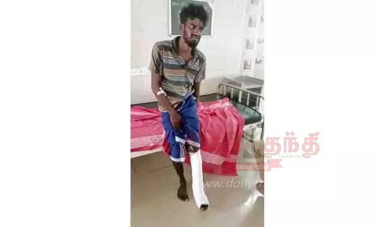 புதுக்கோட்டையில் போலீசார் பிடியில் இருந்து தப்பியோட முயன்ற கைதியின் கால் முறிந்தது
