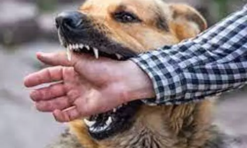 வெறிநாய் கடித்து 15 பேர் படுகாயம் வெறிநாய் கடித்து 15 பேர் படுகாயம்