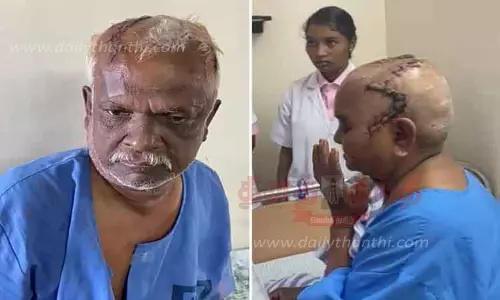 வீடு புகுந்து வயதான தம்பதியை தாக்கி 10 பவுன் நகை பறிப்பு