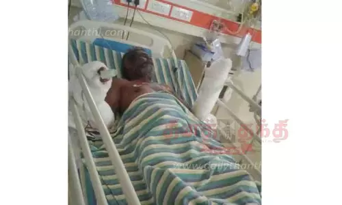 நங்கூர ரோப் சுற்றி தொழிலாளியின் கைகள் சிதைந்தன