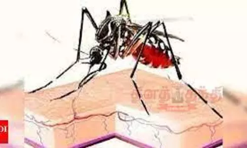 கல்லூரி மாணவி டெங்கு காய்ச்சலுக்கு அனுமதி கல்லூரி மாணவி டெங்கு காய்ச்சலுக்கு அனுமதி