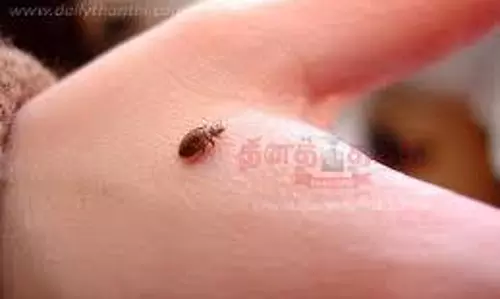 விஷ பூச்சி கடித்து மூதாட்டி சாவு