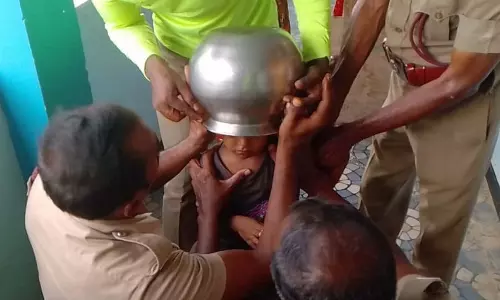 சிறுவனின் தலையில் சிக்கிய பாத்திரம்