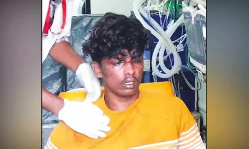 கொடைக்கானல் வனப்பகுதியில் 100 அடி பள்ளத்தில் தவறி விழுந்த கல்லூரி மாணவர்; மரக்கிளையை பிடித்து உயிர் தப்பினார் கொடைக்கானல் வனப்பகுதியில் 100 அடி பள்ளத்தில் தவறி விழுந்த கல்லூரி மாணவர்; மரக்கிளையை பிடித்து உயிர் தப்பினார்