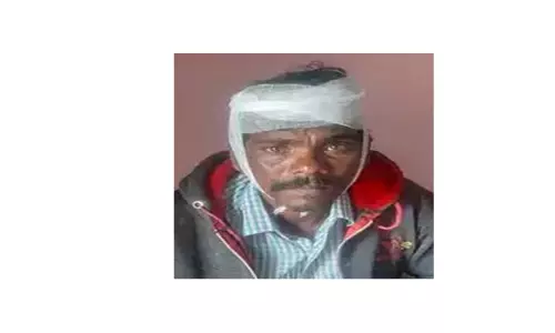 விவசாயி படுகாயம்