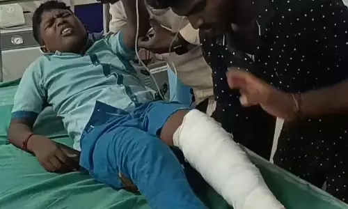 உளுந்தூர்பேட்டையில் அரசு பஸ் சக்கரத்தில் சிக்கி மாணவரின் கால் முறிந்தது உளுந்தூர்பேட்டையில் அரசு பஸ் சக்கரத்தில் சிக்கி மாணவரின் கால் முறிந்தது