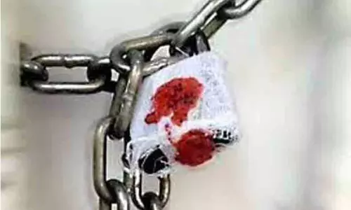 கெட்டுப்போன பிரியாணி விற்ற ஓட்டலுக்கு சீல்