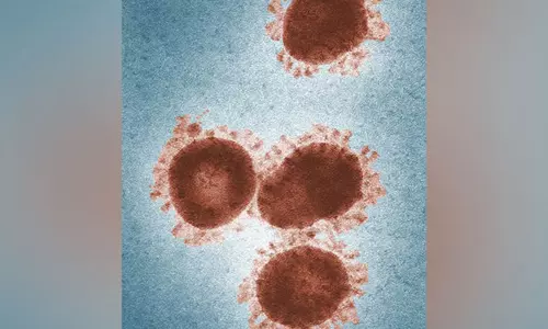 பேரழிவை ஏற்படுத்தலாம்.. பனிப்பாறைகளுக்குள் புதைந்து இருக்கும் ஆபத்து: விஞ்ஞானிகள் எச்சரிக்கை பேரழிவை ஏற்படுத்தலாம்.. பனிப்பாறைகளுக்குள் புதைந்து இருக்கும் ஆபத்து: விஞ்ஞானிகள் எச்சரிக்கை