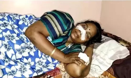 துக்க நிகழ்ச்சிக்கு வந்தபோது விபரீதம்:  மனைவியின் மூக்கை அறுத்த கணவர்