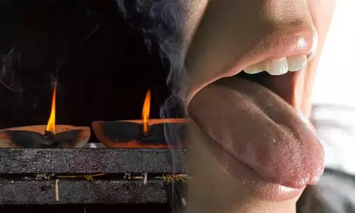 மனைவிக்கு பேச்சு வர வேண்டும் என வேண்டி காணிக்கையாக நாக்கை அறுத்துக்கொடுத்த வாலிபர்