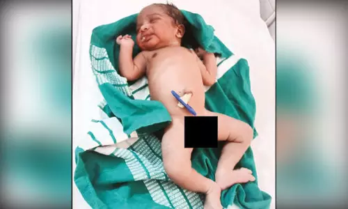 பிறந்து சில மணி நேரமான ஆண் குழந்தை முட்புதரில் இருந்து மீட்பு பிறந்து சில மணி நேரமான ஆண் குழந்தை முட்புதரில் இருந்து மீட்பு