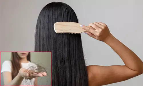 தலைமுடி நிறைய கொட்டுகிறதா..? இதெல்லாம் காரணமாக இருக்கலாம் தலைமுடி நிறைய கொட்டுகிறதா..? இதெல்லாம் காரணமாக இருக்கலாம்