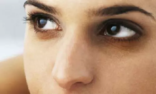 கண்களை சுற்றி கருவளையமா..? காரணங்களும் தீர்வுகளும்..! கண்களை சுற்றி கருவளையமா..? காரணங்களும் தீர்வுகளும்..!