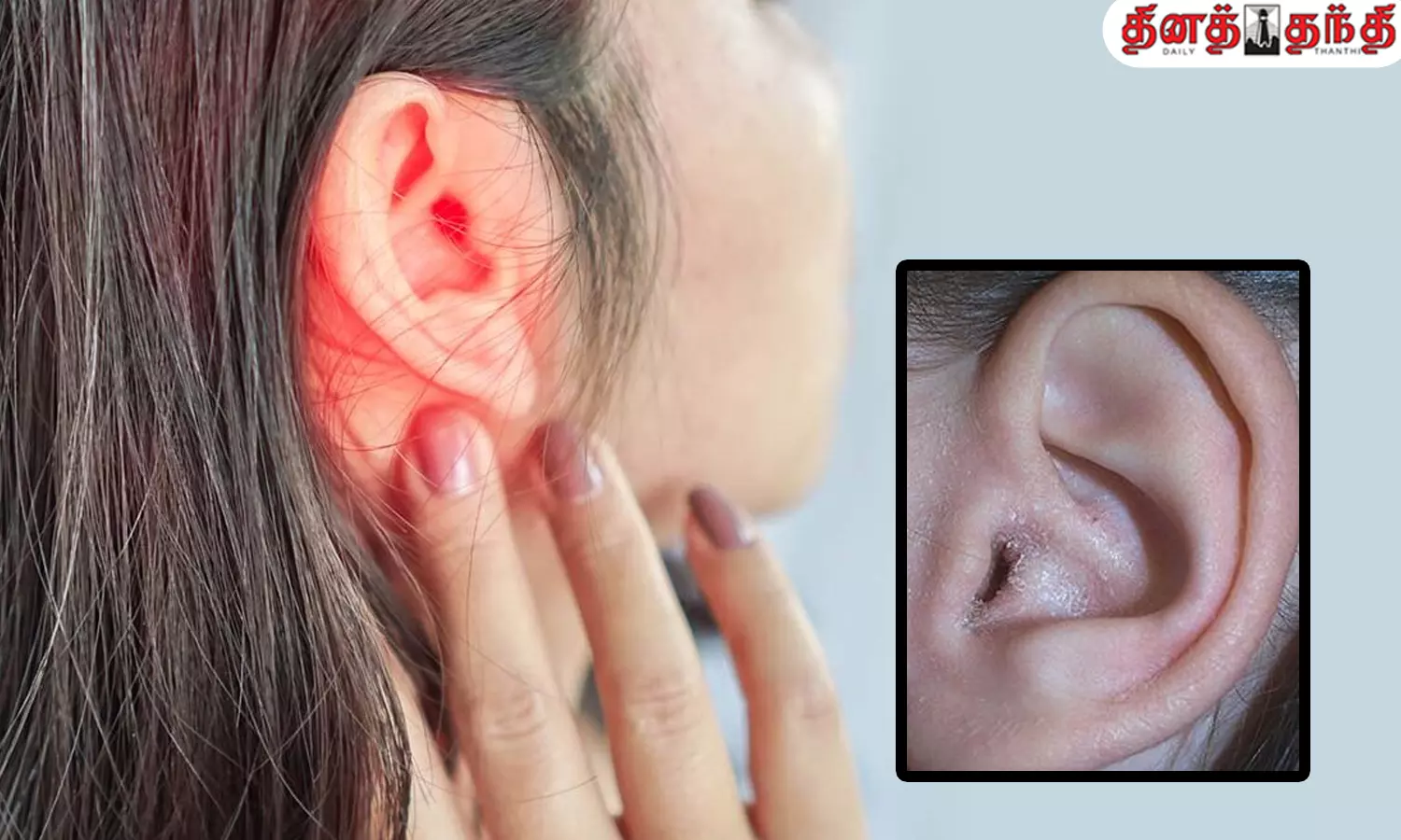 காதில் இருந்து சீழ் வடிகிறதா..?