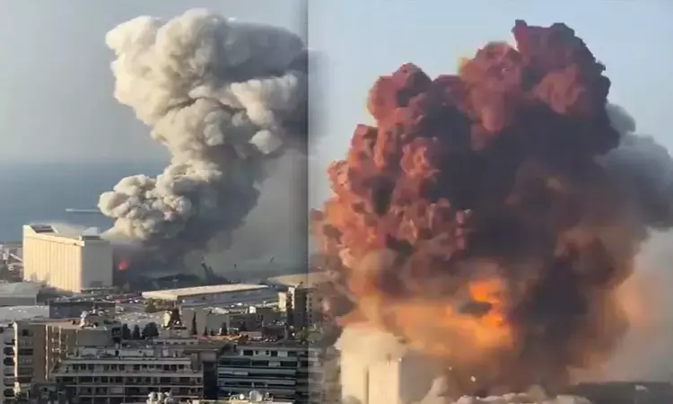 ஈரான் துறைமுக வெடி விபத்து - மேலும் உயர்ந்த பலி... ... இன்றைய முக்கிய செய்திகள்.. சில வரிகளில் 27-04-2025 ஈரான் துறைமுக வெடி விபத்து - மேலும் உயர்ந்த பலி... ... இன்றைய முக்கிய செய்திகள்.. சில வரிகளில் 27-04-2025