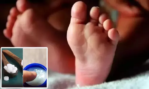 கற்பூரம், தைலம் சேர்த்து தேய்த்ததால் 8 மாத பெண் குழந்தை உயிரிழப்பு? - பிரேத பரிசோதனை அறிக்கையில் வெளியான தகவல்