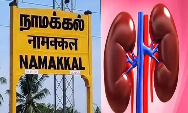 நாமக்கல் கிட்னி விற்பனை விவகாரம்:  மக்கள் நல்வாழ்வுத்துறை அறிக்கை