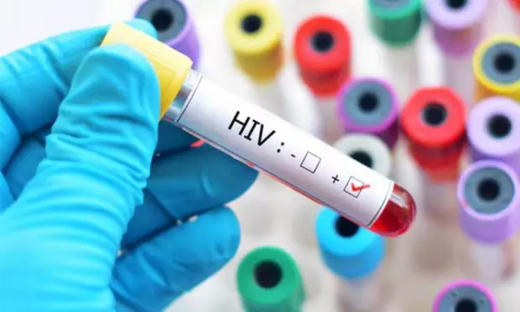 திருமணத்துக்கு முன்பு எச்.ஐ.வி. பரிசோதனை கட்டாயம் - மேகாலயாவில் சட்டம் வருகிறது
