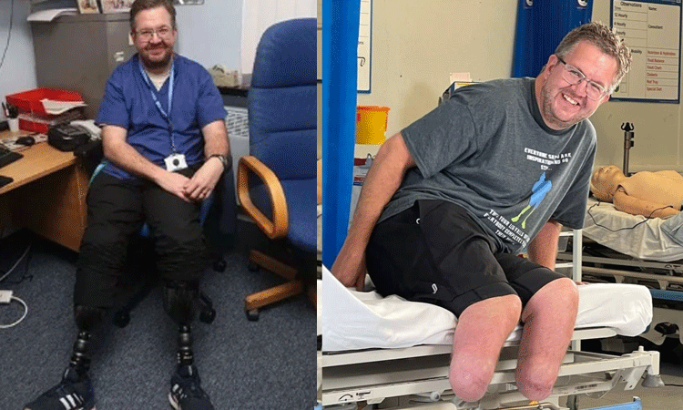 ரூ.5 கோடி காப்பீட்டு தொகைக்காக  2 கால்களை வெட்டிய நபர்: கண்டுபிடித்த காப்பீட்டு நிறுவனம்