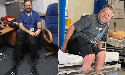 ரூ.5 கோடி காப்பீட்டு தொகைக்காக  2 கால்களை வெட்டிய நபர்: கண்டுபிடித்த காப்பீட்டு நிறுவனம்