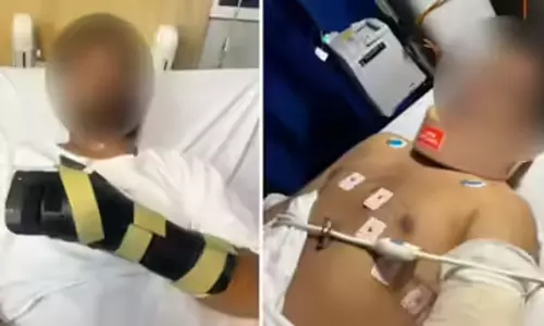 ஆஸ்திரேலியாவில் இந்தியர் மீது கொடூர தாக்குதல் - அதிர்ச்சி சம்பவம் ஆஸ்திரேலியாவில் இந்தியர் மீது கொடூர தாக்குதல் - அதிர்ச்சி சம்பவம்