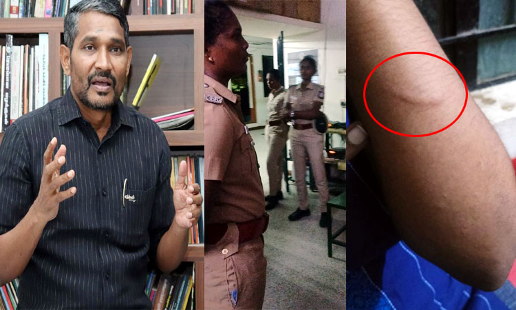 ஏன் கைது செய்கிறீர்கள்? என கேள்வி கேட்ட இருவரை போலீசார் தாக்கியுள்ளனர்: வன்னி அரசு