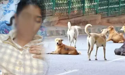 கல்லூரி மாணவியை கடித்துக் குதறிய தெருநாய்கள்; முகத்தில் 17 தையல்கள் போடப்பட்டு தீவிர சிகிச்சை கல்லூரி மாணவியை கடித்துக் குதறிய தெருநாய்கள்; முகத்தில் 17 தையல்கள் போடப்பட்டு தீவிர சிகிச்சை