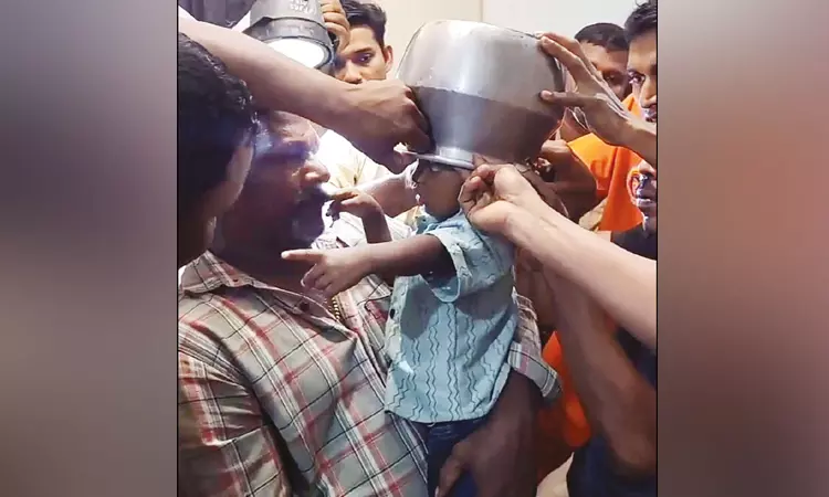 குழந்தையின் தலையில் சிக்கிய பாத்திரம்.. தீயணைப்பு வீரர்கள் போராடி அகற்றினர்