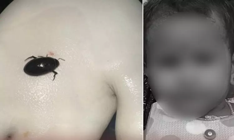 மூச்சுக்குழாயில் வண்டு கடித்து குழந்தை உயிரிழப்பு ... ... இன்றைய முக்கிய செய்திகள் சில வரிகளில்.. 25-08-2025 மூச்சுக்குழாயில் வண்டு கடித்து குழந்தை உயிரிழப்பு ... ... இன்றைய முக்கிய செய்திகள் சில வரிகளில்.. 25-08-2025