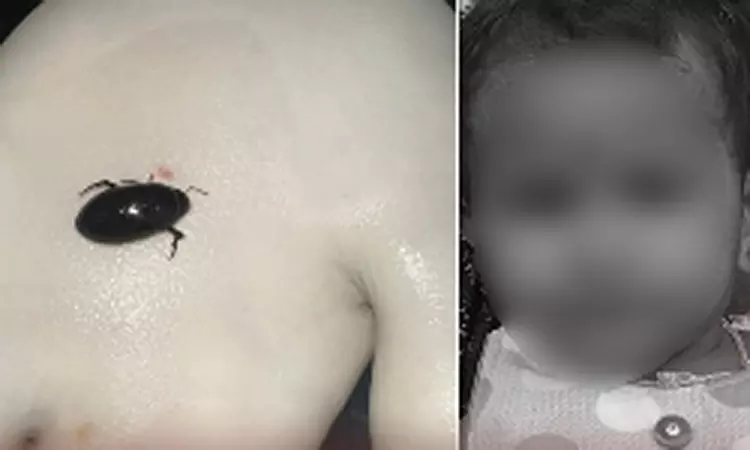 மூச்சுக்குழாயில் வண்டு கடித்து குழந்தை உயிரிழப்பு: திருவள்ளூர் அருகே சோகம்