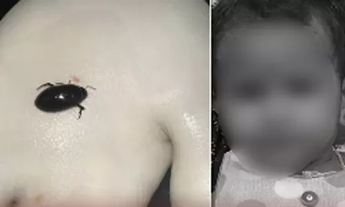 மூச்சுக்குழாயில் வண்டு கடித்து குழந்தை உயிரிழப்பு: திருவள்ளூர் அருகே சோகம்