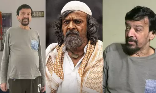KGF actor looks unrecognizable...Fans worried