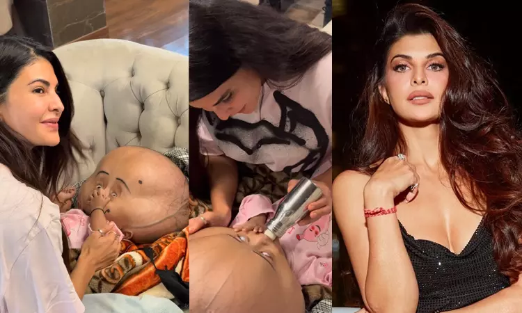 Jacqueline Fernandez visits child with rare condition, pledges support