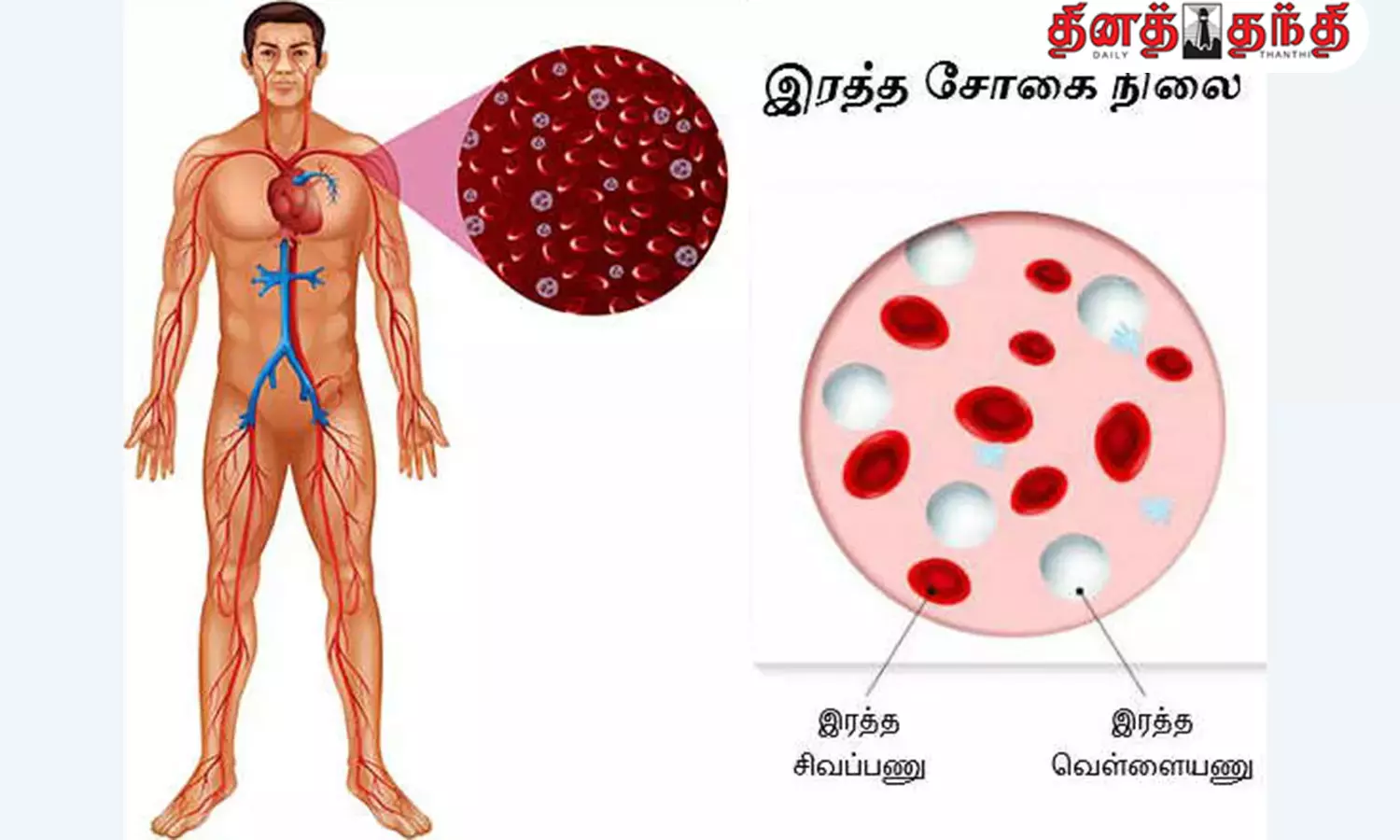 ரத்தசோகையை போக்கும் பழங்கள் எவை தெரியுமா?