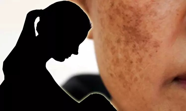 முகத்தில் ஏற்பட்ட கரும்புள்ளி... விரக்தியில் பெண் எடுத்த விபரீத முடிவு முகத்தில் ஏற்பட்ட கரும்புள்ளி... விரக்தியில் பெண் எடுத்த விபரீத முடிவு