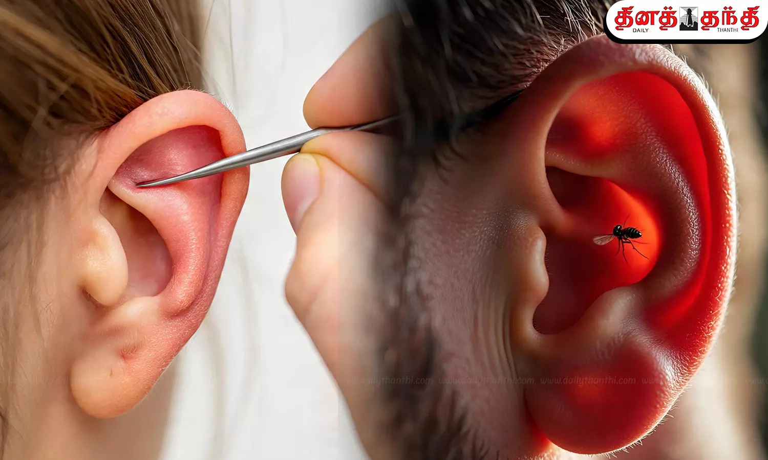 காதுகளில் பூச்சி புகுந்து விட்டால் என்ன செய்யலாம் தெரியுமா?