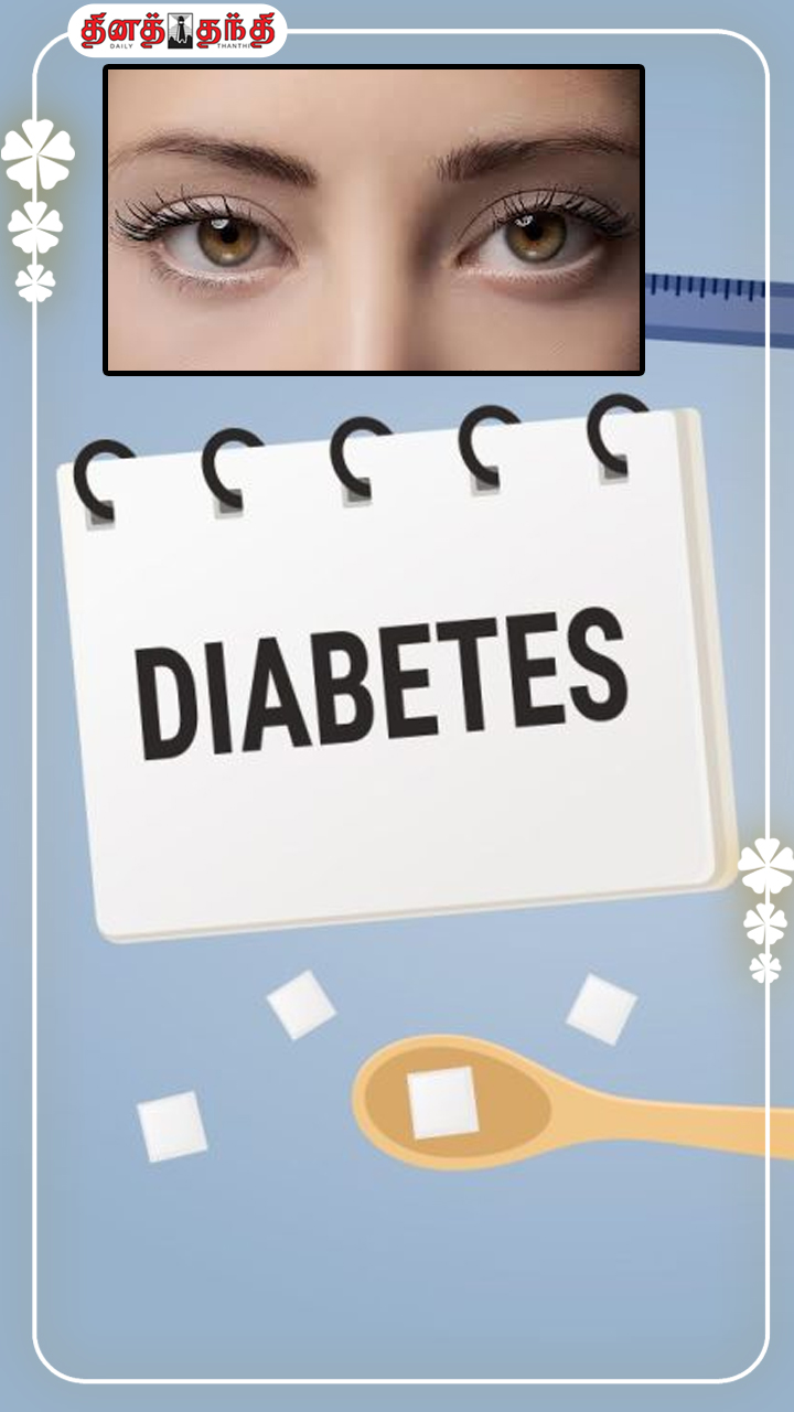 டயாபட்டீஸ் வந்த உடனே கண்பார்வை பறிபோகுமா? டயாபட்டீஸ் வந்த உடனே கண்பார்வை பறிபோகுமா?
