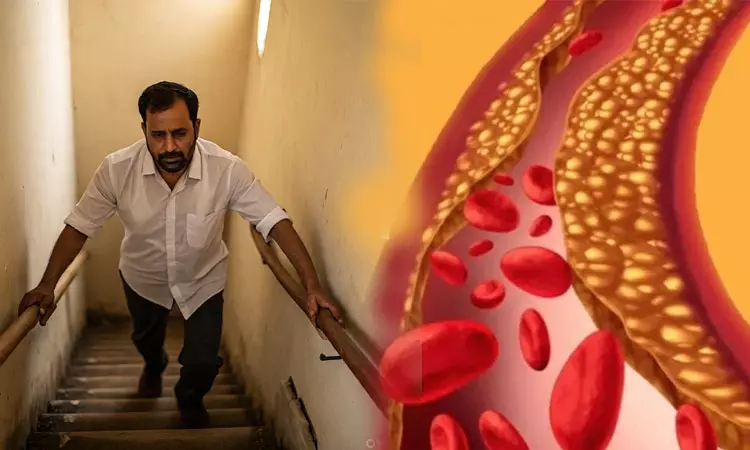 உடலில் கெட்ட கொழுப்பு அதிகரித்தால் இந்த உறுப்புகள் எச்சரிக்கை செய்யும் உடலில் கெட்ட கொழுப்பு அதிகரித்தால் இந்த உறுப்புகள் எச்சரிக்கை செய்யும்