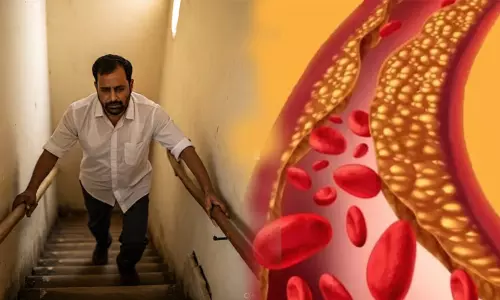 உடலில் கெட்ட கொழுப்பு அதிகரித்தால் இந்த உறுப்புகள் எச்சரிக்கை செய்யும் உடலில் கெட்ட கொழுப்பு அதிகரித்தால் இந்த உறுப்புகள் எச்சரிக்கை செய்யும்