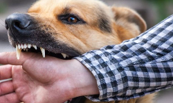 சென்னையில் சிறுவனை கடித்துக்குதறிய தெருநாய் சென்னையில் சிறுவனை கடித்துக்குதறிய தெருநாய்