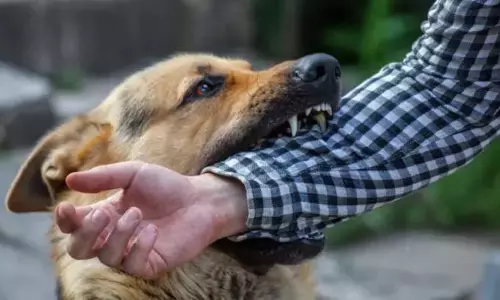 வளர்ப்பு நாய் கடித்து உரிமையாளர் சாவு - தடுப்பூசி செலுத்தியும் இறந்த பரிதாபம்